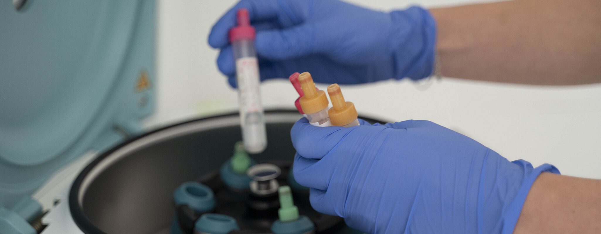 Blutproben werden f&uuml;r die Zentrifuge vorbereitet