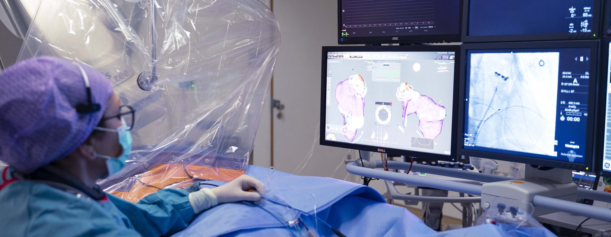 OP mit Pulsfeld-Katheter